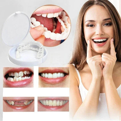 Snap on Smile Veneers