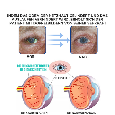 KlarTropfen™ Rötung Schnell Lindern